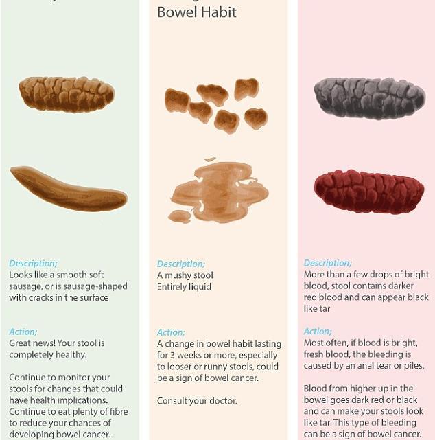 Your poo could reveal clues to your health | Newshub