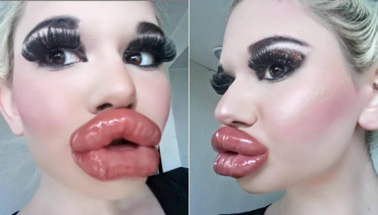Woman with 'world's biggest lips' says she's not done w...