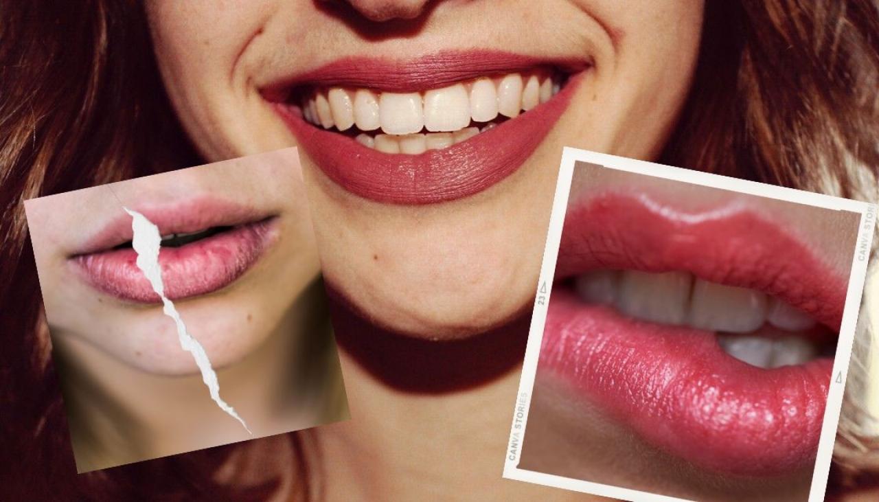 How To Beat Dry Lips This Winter The Ultimate Guide To Keeping Your