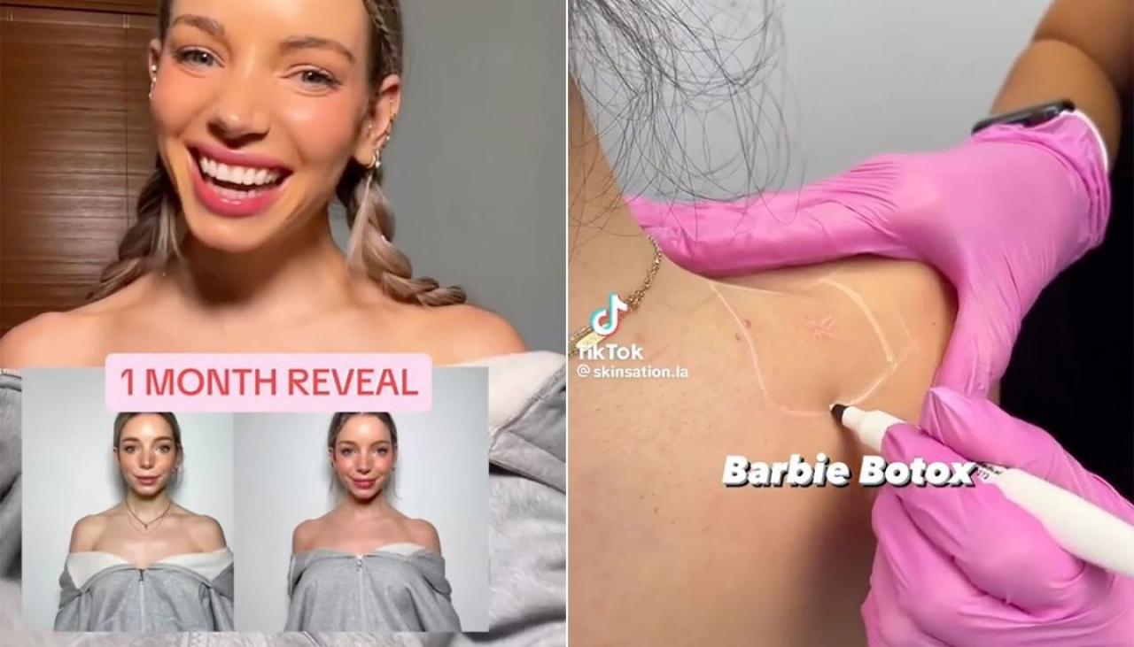 Barbie Botox: Why cosmetically slimming shoulders is TikTok's latest beauty  obsession | Newshub