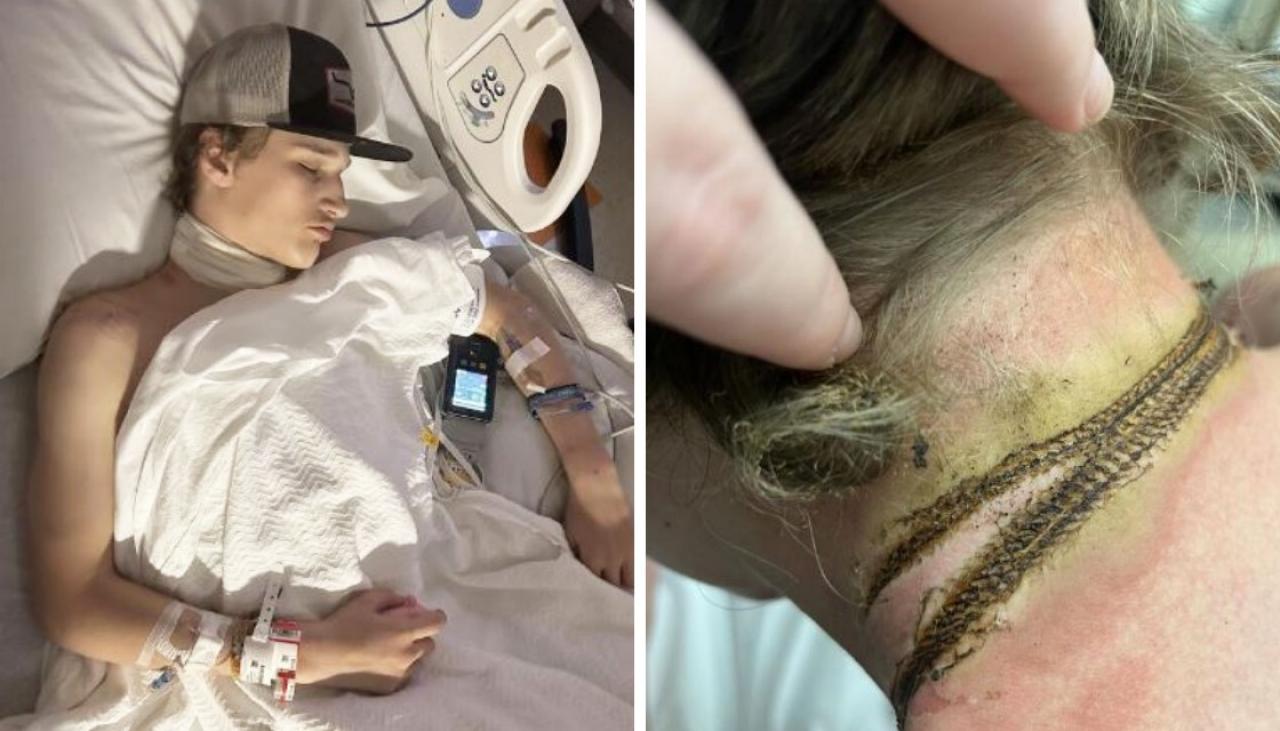 Amerikalı bir genç, telefon şarj cihazı kazasının ardından ölümün eşiğinde ve “sıcak bobin” nedeniyle boynu elektriklendi.