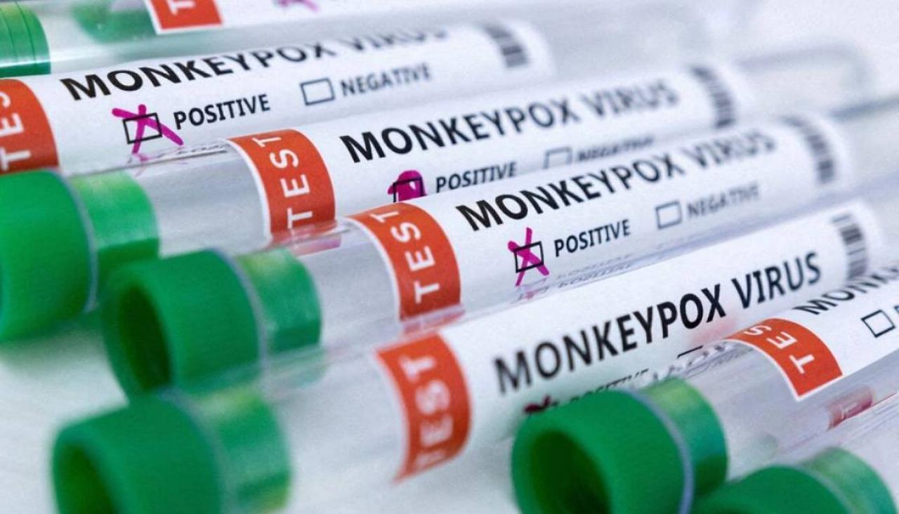 Wastewater testing for monkeypox being trialled in New Zealand's main  cities | Newshub