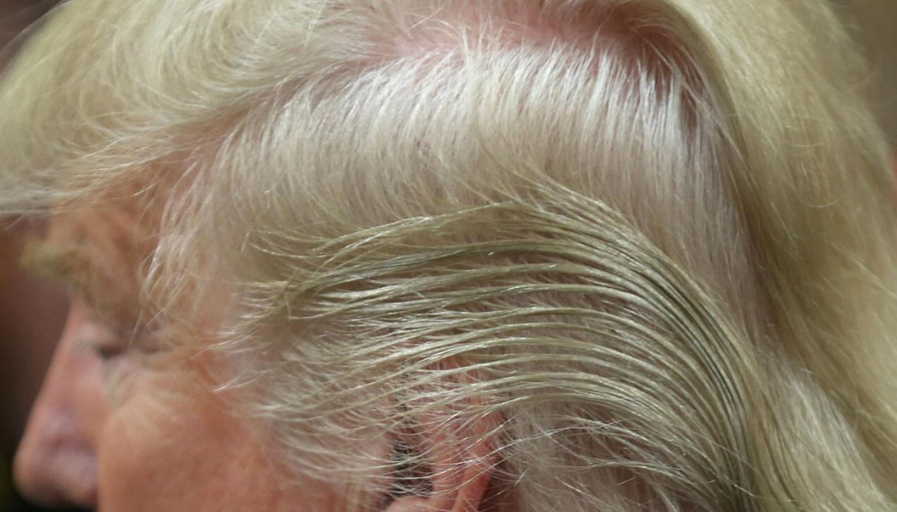 Trump's doctor reveals the secret behind his hair  Newshub