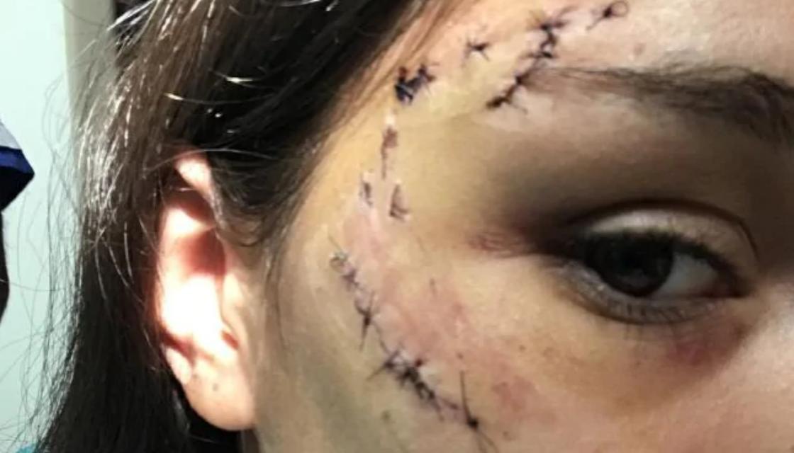 Image result for argentina teen girl dog bite image